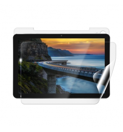 Screenshield IGET Smart W30 fólie na celé tělo
